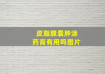 皮脂腺囊肿涂药膏有用吗图片