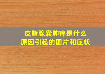 皮脂腺囊肿痒是什么原因引起的图片和症状