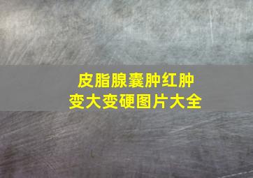 皮脂腺囊肿红肿变大变硬图片大全