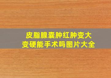 皮脂腺囊肿红肿变大变硬能手术吗图片大全