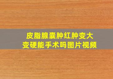 皮脂腺囊肿红肿变大变硬能手术吗图片视频