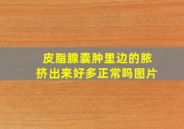 皮脂腺囊肿里边的脓挤出来好多正常吗图片