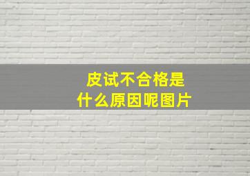 皮试不合格是什么原因呢图片