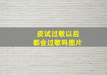 皮试过敏以后都会过敏吗图片