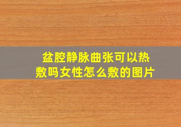 盆腔静脉曲张可以热敷吗女性怎么敷的图片