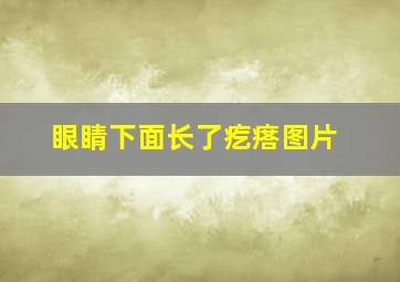 眼睛下面长了疙瘩图片