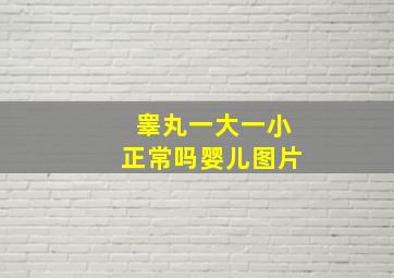 睾丸一大一小正常吗婴儿图片