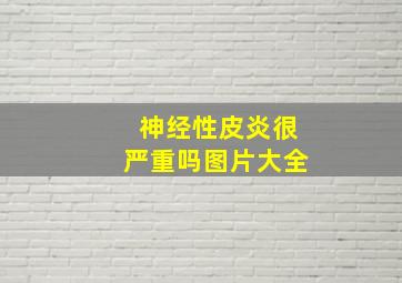 神经性皮炎很严重吗图片大全