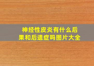 神经性皮炎有什么后果和后遗症吗图片大全