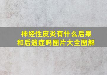 神经性皮炎有什么后果和后遗症吗图片大全图解