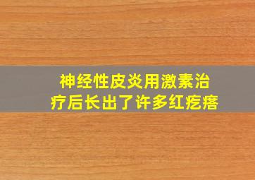 神经性皮炎用激素治疗后长出了许多红疙瘩