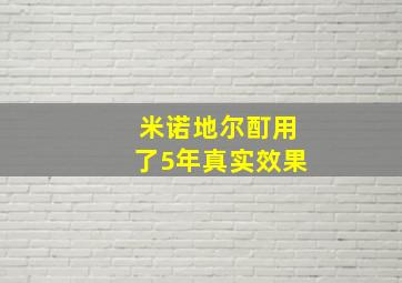 米诺地尔酊用了5年真实效果