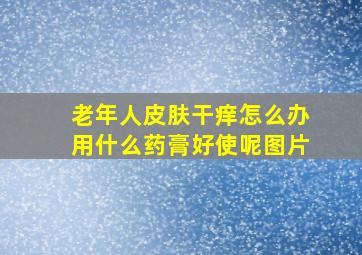 老年人皮肤干痒怎么办用什么药膏好使呢图片