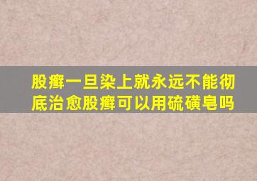 股癣一旦染上就永远不能彻底治愈股癣可以用硫磺皂吗