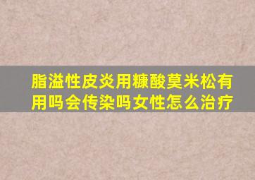 脂溢性皮炎用糠酸莫米松有用吗会传染吗女性怎么治疗