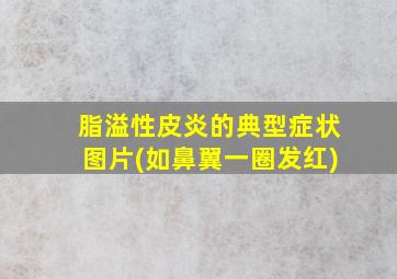 脂溢性皮炎的典型症状图片(如鼻翼一圈发红)