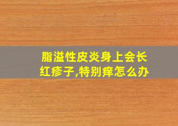 脂溢性皮炎身上会长红疹子,特别痒怎么办