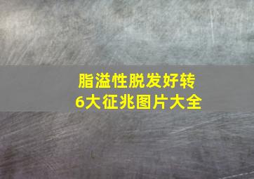 脂溢性脱发好转6大征兆图片大全