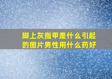 脚上灰指甲是什么引起的图片男性用什么药好