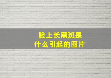 脸上长黑斑是什么引起的图片