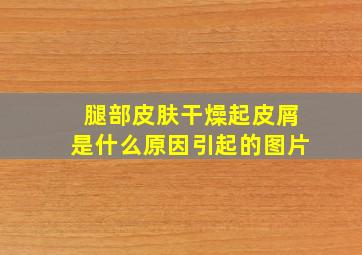 腿部皮肤干燥起皮屑是什么原因引起的图片