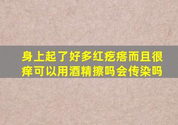 身上起了好多红疙瘩而且很痒可以用酒精擦吗会传染吗