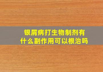 银屑病打生物制剂有什么副作用可以根治吗