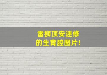 雷狮顶安迷修的生育腔图片!