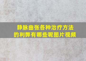 静脉曲张各种治疗方法的利弊有哪些呢图片视频