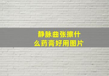 静脉曲张擦什么药膏好用图片