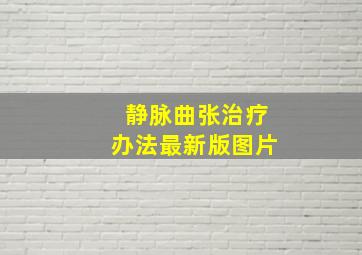 静脉曲张治疗办法最新版图片