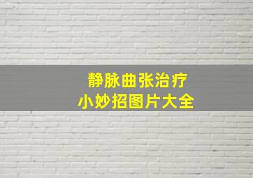 静脉曲张治疗小妙招图片大全