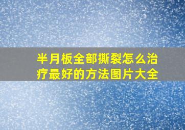 半月板全部撕裂怎么治疗最好的方法图片大全