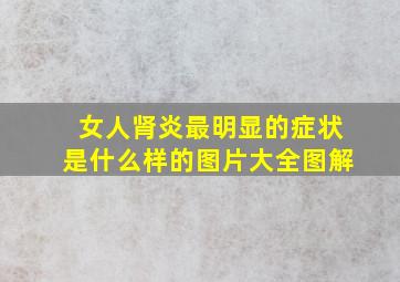 女人肾炎最明显的症状是什么样的图片大全图解