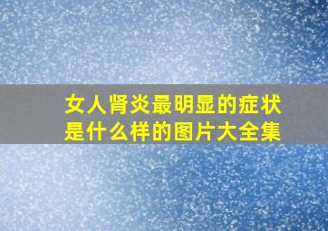 女人肾炎最明显的症状是什么样的图片大全集