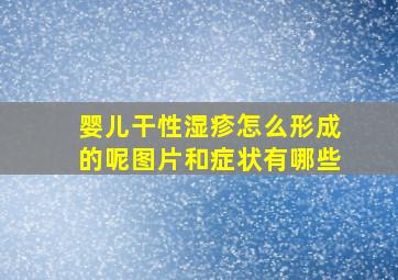 婴儿干性湿疹怎么形成的呢图片和症状有哪些