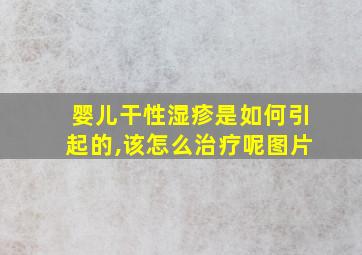 婴儿干性湿疹是如何引起的,该怎么治疗呢图片