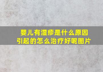 婴儿有湿疹是什么原因引起的怎么治疗好呢图片