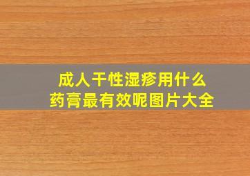 成人干性湿疹用什么药膏最有效呢图片大全