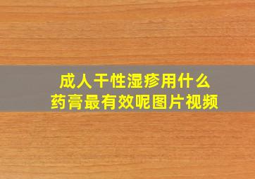 成人干性湿疹用什么药膏最有效呢图片视频