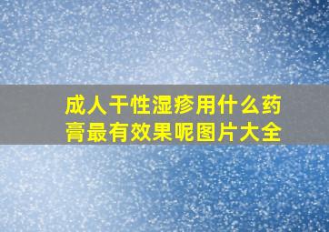 成人干性湿疹用什么药膏最有效果呢图片大全