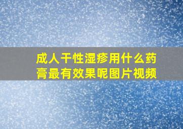 成人干性湿疹用什么药膏最有效果呢图片视频