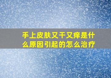 手上皮肤又干又痒是什么原因引起的怎么治疗