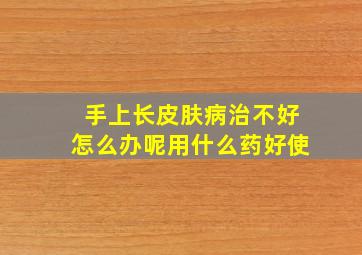 手上长皮肤病治不好怎么办呢用什么药好使