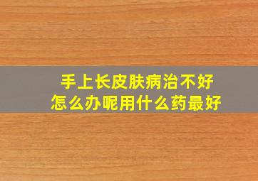 手上长皮肤病治不好怎么办呢用什么药最好