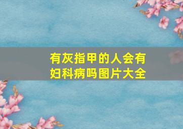 有灰指甲的人会有妇科病吗图片大全