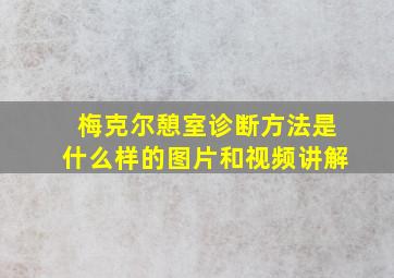 梅克尔憩室诊断方法是什么样的图片和视频讲解