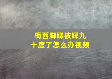 梅西脚踝被踩九十度了怎么办视频