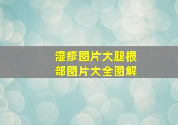 湿疹图片大腿根部图片大全图解