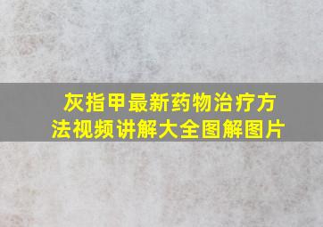 灰指甲最新药物治疗方法视频讲解大全图解图片